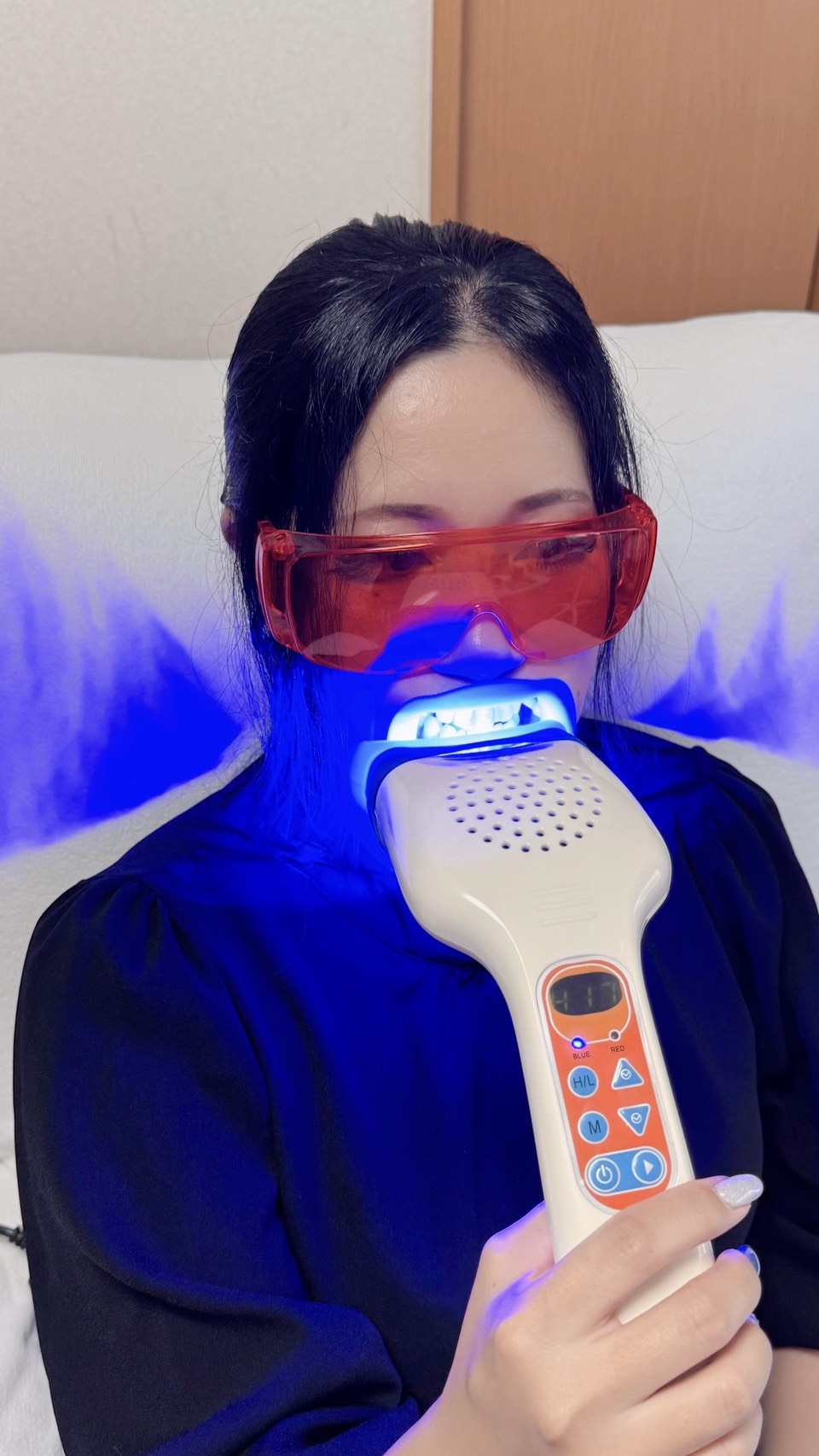 自宅でLEDハンディ照射器を使って医療提携ホワイトニングをする女性